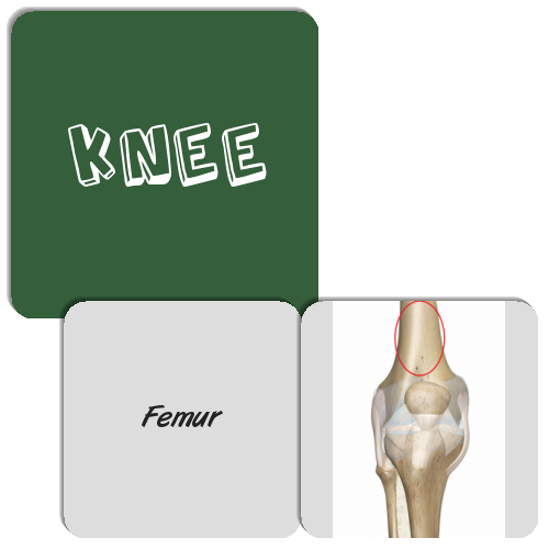 Knee'd For Joints Match The Memory